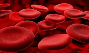 راهکارهای درمان کم خونی